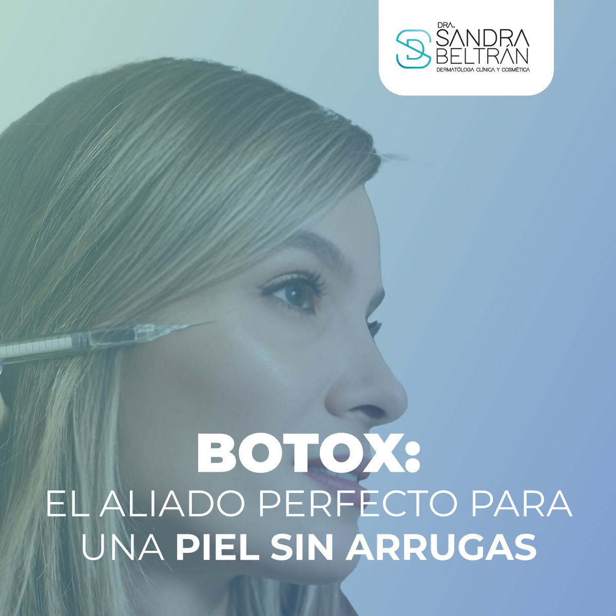 Botox: El aliado perfecto para una piel sin arrugas
