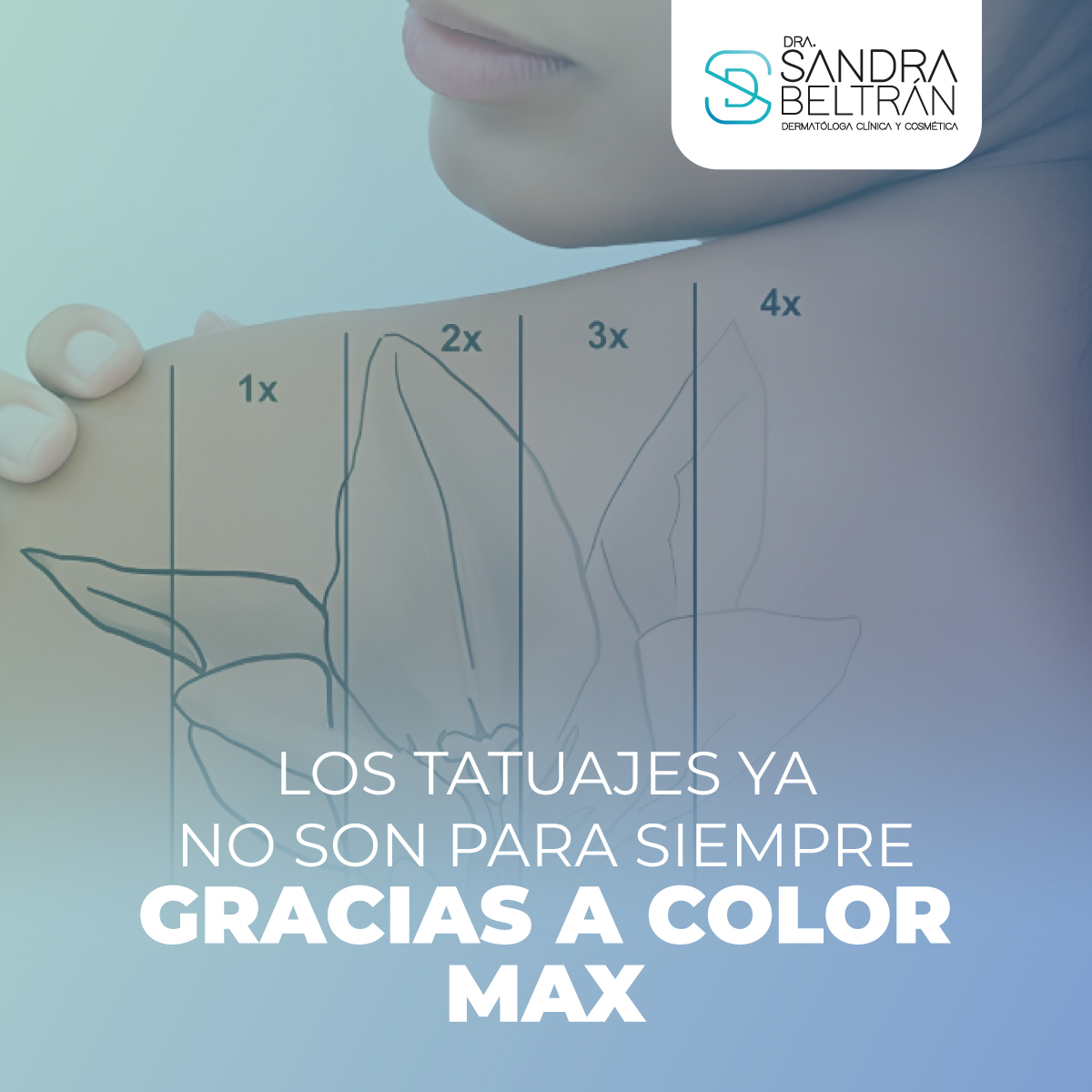 Los tatuajes ya no son para siempre gracias a Color Max