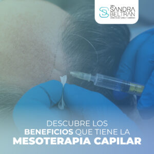 Descubre los beneficios que tiene la mesoterapia capilar