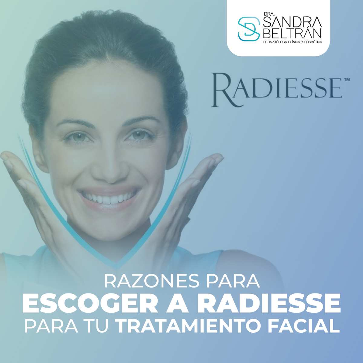 Razones para escoger a Radiesse para tu tratamiento facial