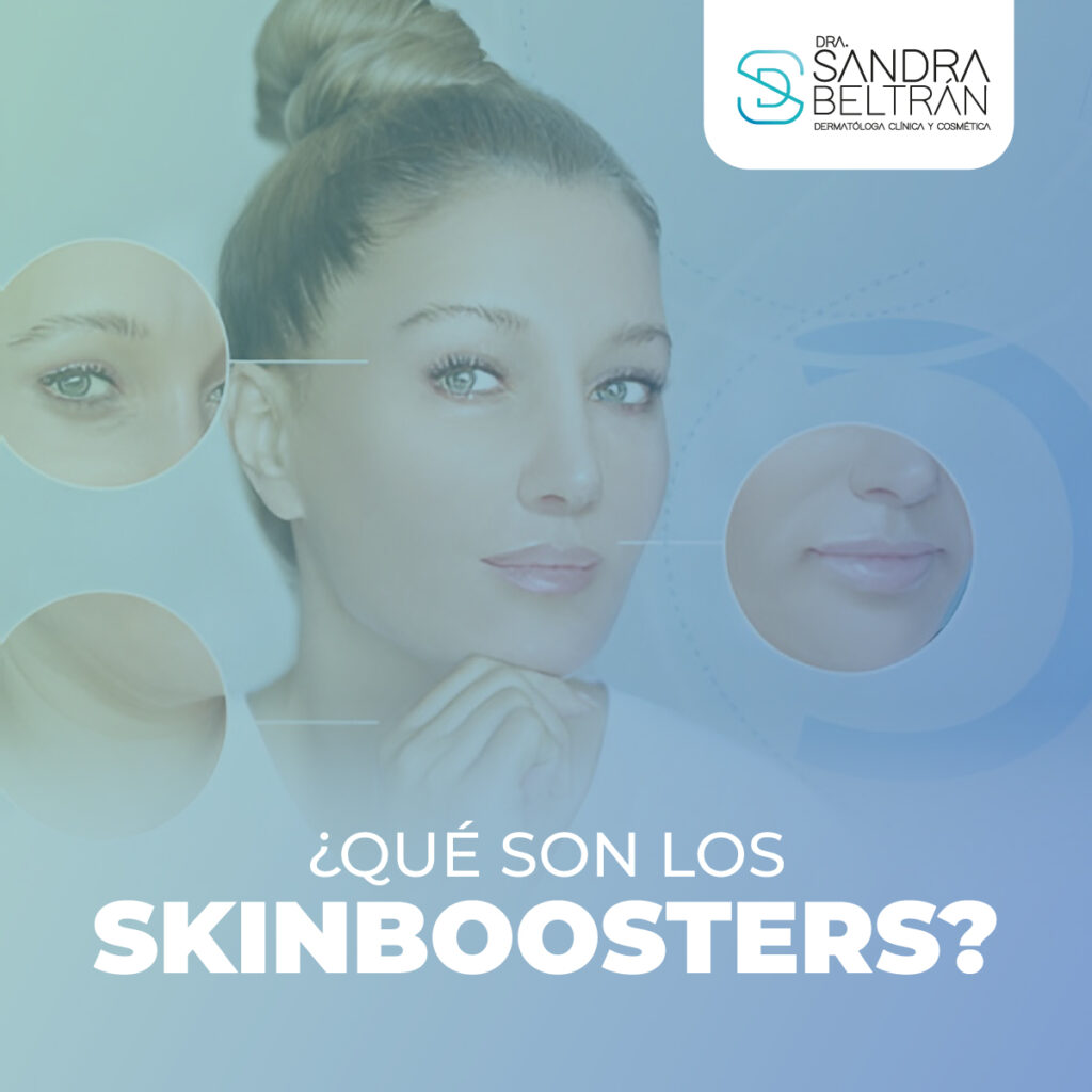 ¿Qué son los skinboosters?