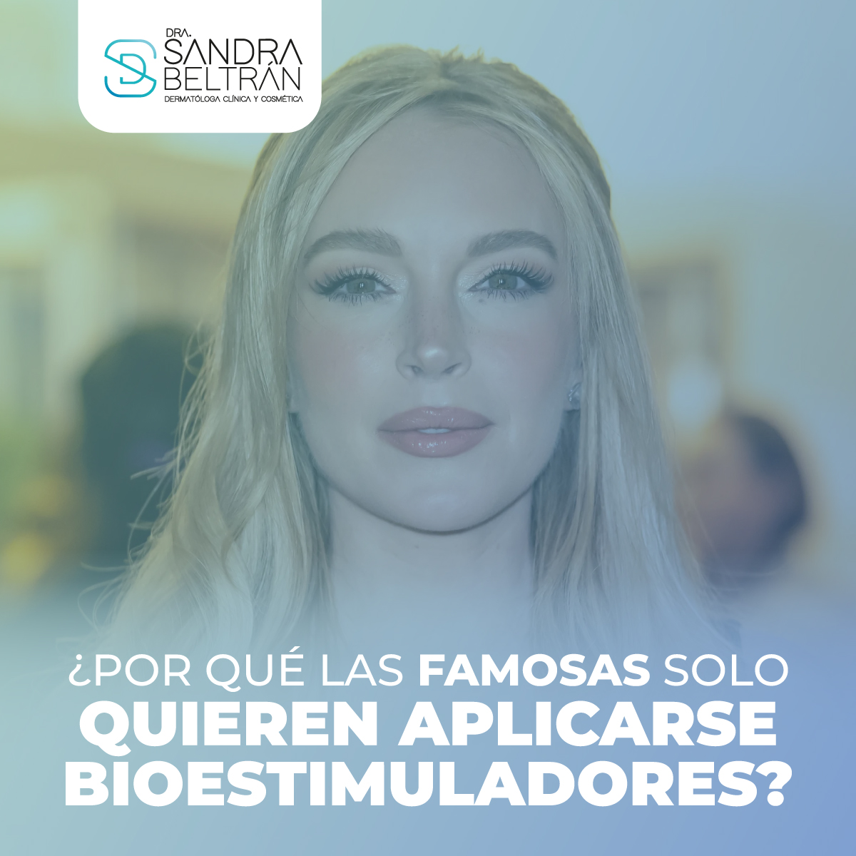 ¿Por qué las famosas solo quieren aplicarse bioestimuladores?