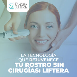 La tecnología que rejuvenece tu rostro sin cirugías: Liftera