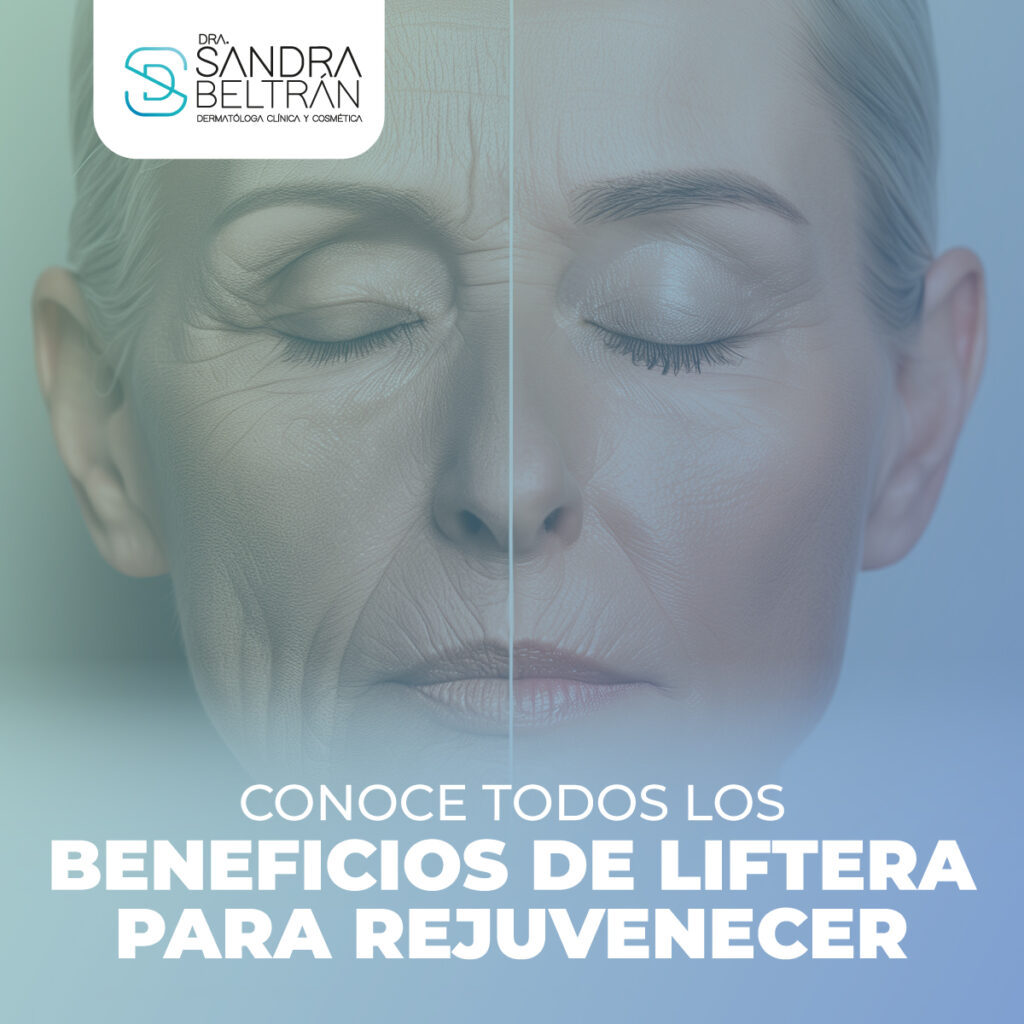 Conoce todos los beneficios de Liftera para rejuvenecer