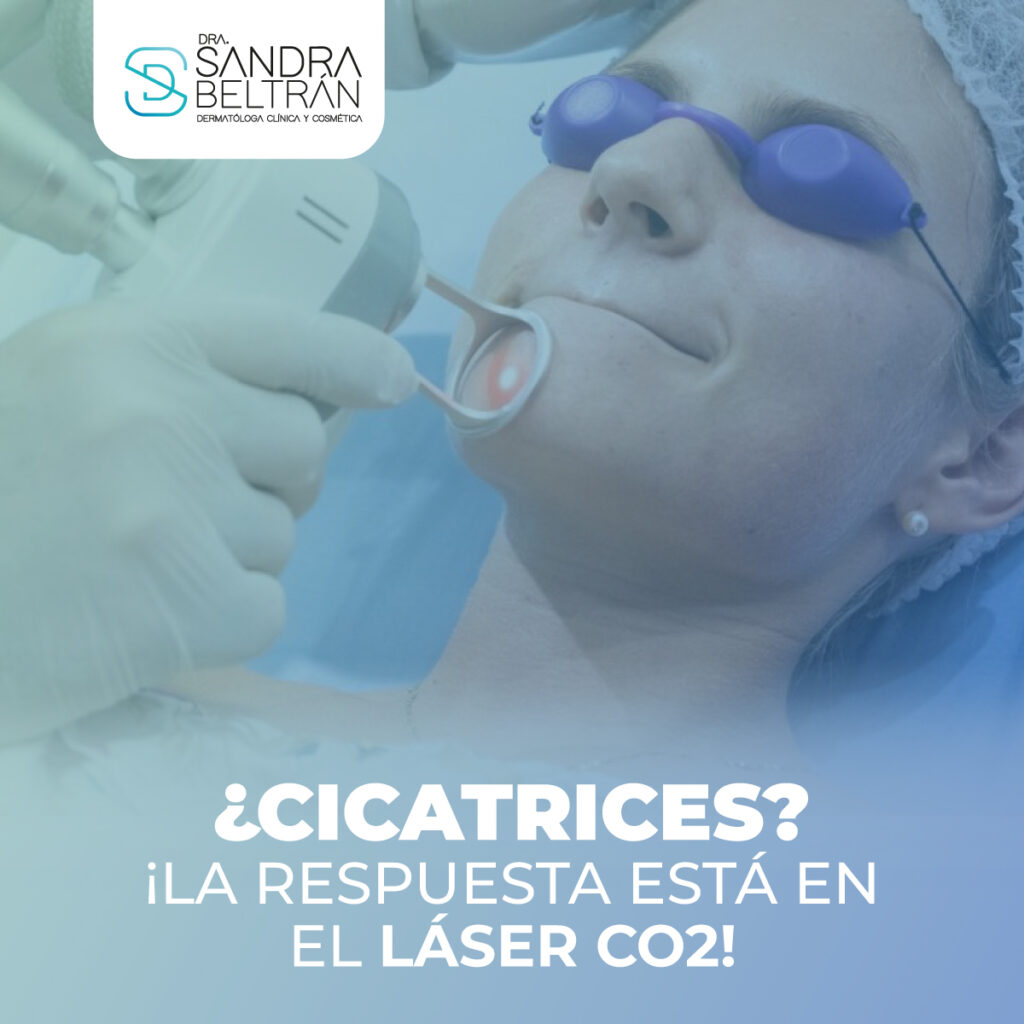 ¿Cicatrices? ¡La respuesta está en el láser CO2!
