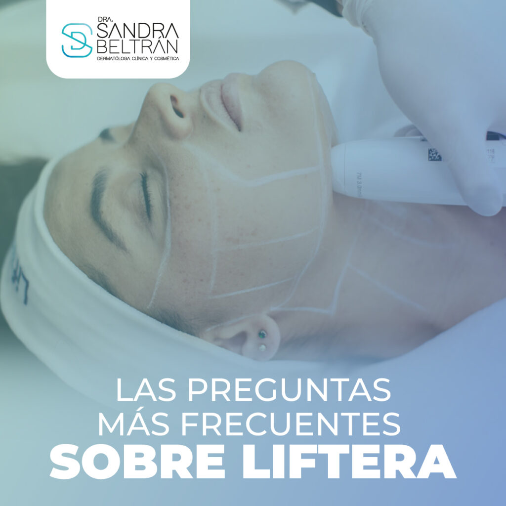 Las preguntas más frecuentes sobre Liftera