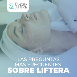 Las preguntas más frecuentes sobre Liftera