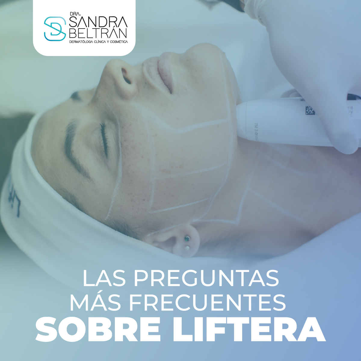 Las preguntas más frecuentes sobre Liftera