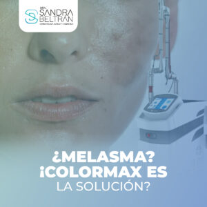 ¿Melasma? ¡Colormax es la solución!