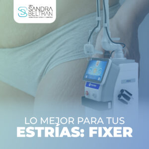 Lo mejor para tus estrías: FIXER